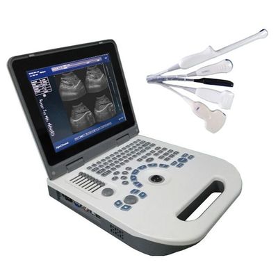 Kualitas  TGC Control Notebook Ultrasound Scanner For Pregnancy Home Use pabrik