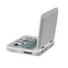 Mesin Ultrasonografi Portabel Warna LED 15 Inci dengan Sudut Pindai 60 Derajat dan Tampilan Kedalaman ≥250mm