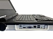 15 Inch LED Color Portable Ultrasound Machine dengan 60deg Scan Angle dan Konfigurasi Probe 2.0MHz-5.0MHz