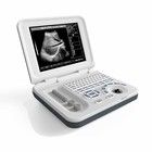 15 Inch LED Color Portable Ultrasound Machine dengan sudut pemindaian 60 derajat dan 8 TGC Control