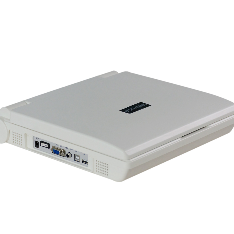 Baterai Li 3000MAH Sistem Ultrasound Diagnostik Portabel Kontrol USG TGC 12.1 Inci