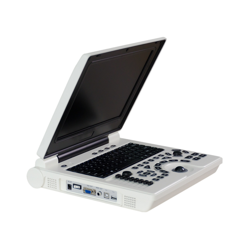 Baterai Li 3000MAH Sistem Ultrasound Diagnostik Portabel Kontrol USG TGC 12.1 Inci