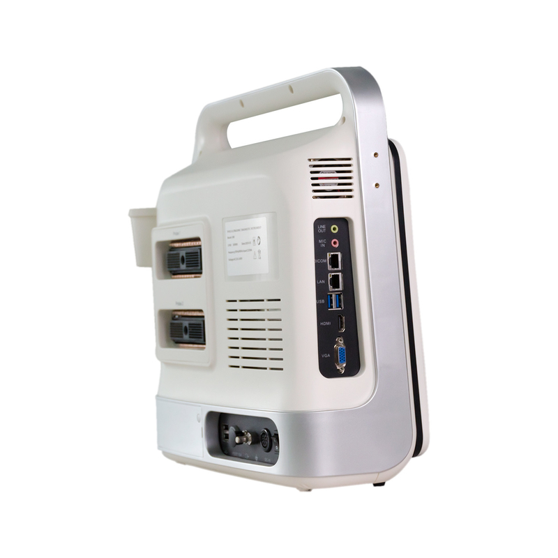 Mesin Ultrasound Doppler Warna Laptop Portabel Kontrol TGC Untuk Jantung Neonatus