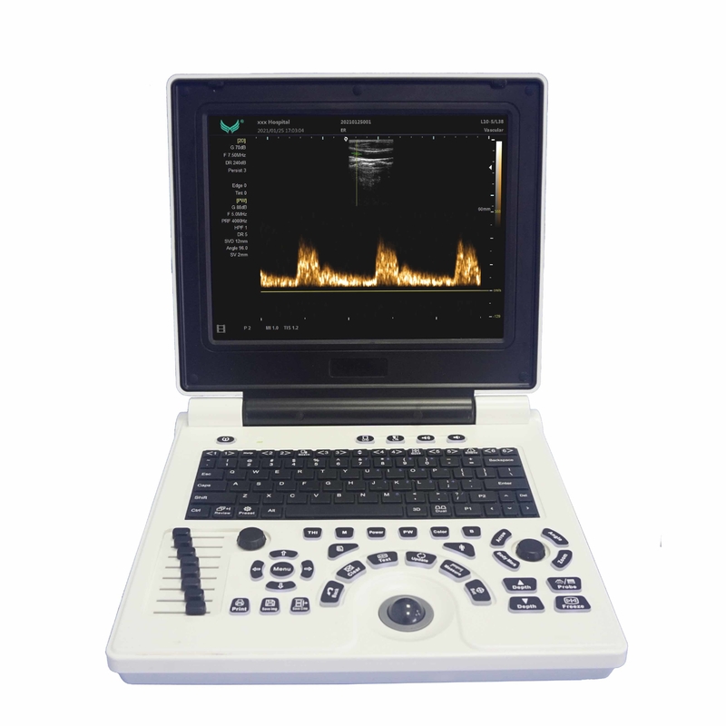 Mesin Ultrasound Doppler Warna Portabel OB GYN Dalam Kehamilan