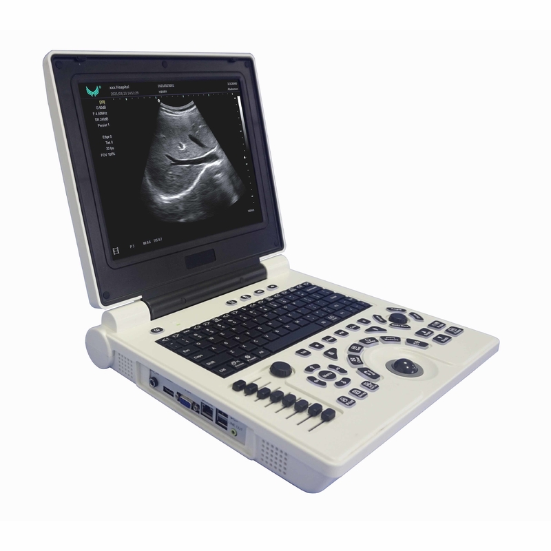 Mesin Ultrasound Doppler Warna Portabel OB GYN Dalam Kehamilan