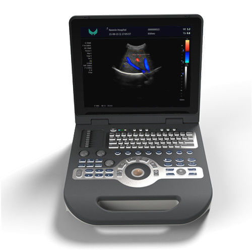 SGS Cardiology Color Ultrasound Scanner 220V Perangkat Ultrasound Doppler Genggam