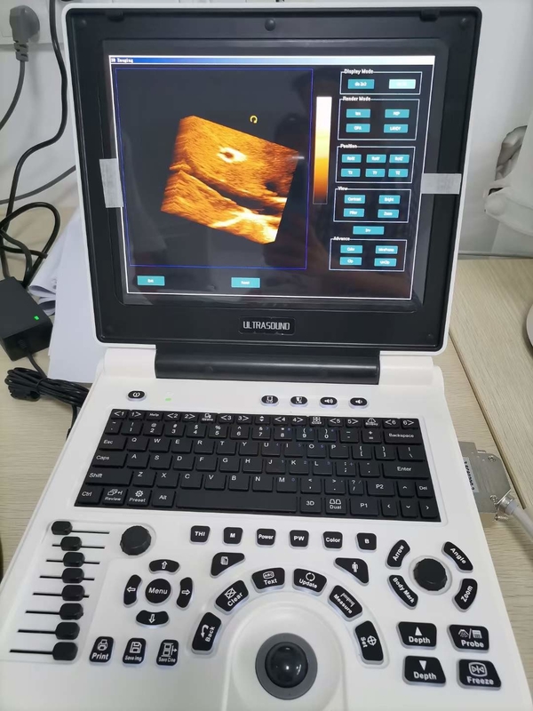 Gambar Mesin Ultrasound Doppler Warna Kehamilan Xianfeng 4B OEM