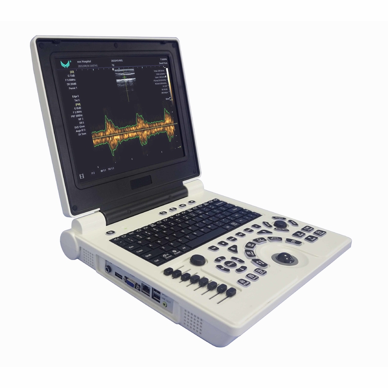 Gambar Mesin Ultrasound Doppler Warna Kehamilan Xianfeng 4B OEM