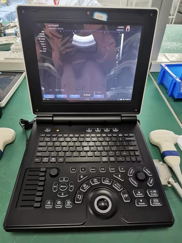 Mesin USG Portabel Tingkat Dasar ISO Sistem Ultrasound Doppler Warna Digital