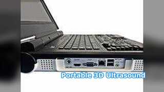 Rumah Sakit Klinik USG Portabel E20