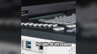 Mesin USG Doppler 4D Portabel Siap ICU