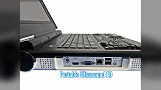 Pemindaian Urologi USG Doppler Warna Portabel E0