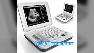 Pemindai Ultrasound Portabel DRF RDA Isi Ulang